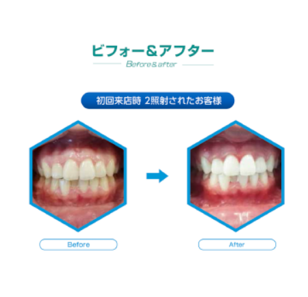 ビフォーアフター