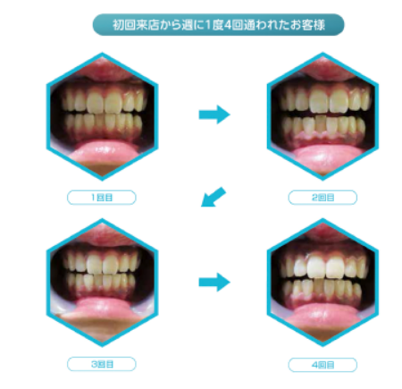 ビフォーアフター