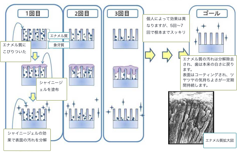 ホワイトニング工程